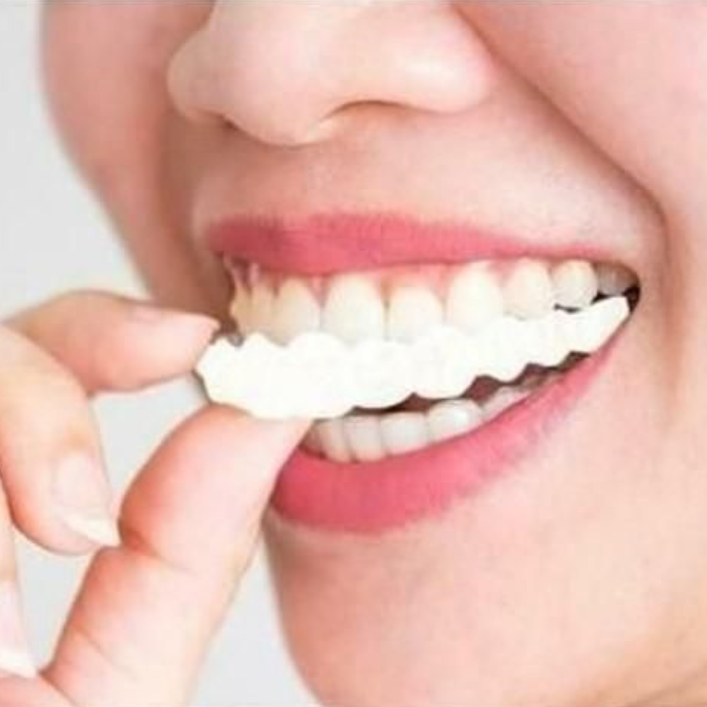 Instant Smile Confidence 😁 – Temporary Teeth Braces Cover