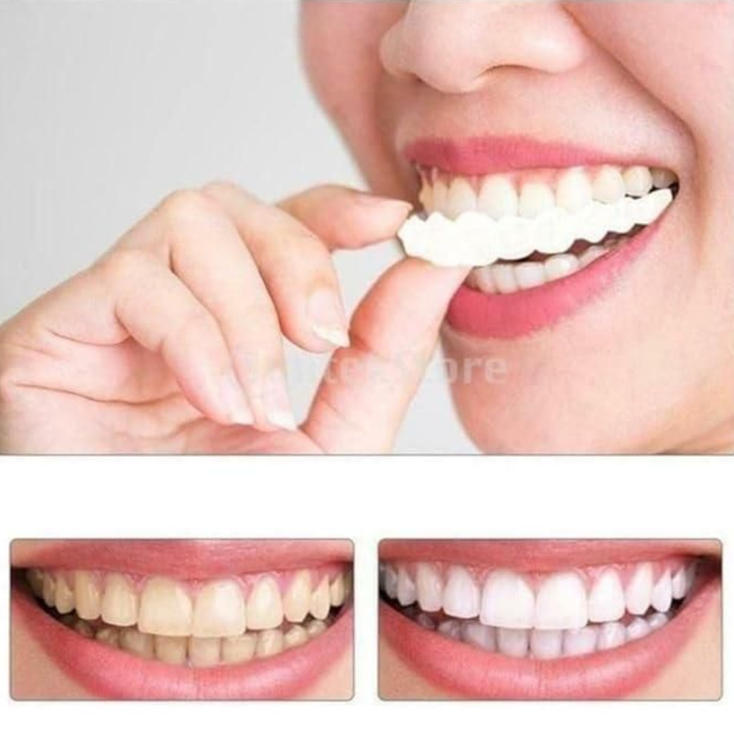 Instant Smile Confidence 😁 – Temporary Teeth Braces Cover
