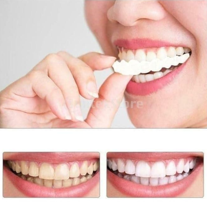 Instant Smile Confidence 😁 – Temporary Teeth Braces Cover