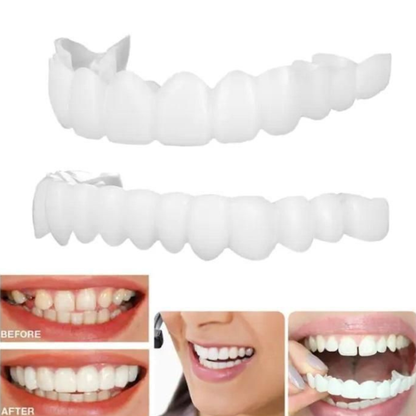Instant Smile Confidence 😁 – Temporary Teeth Braces Cover