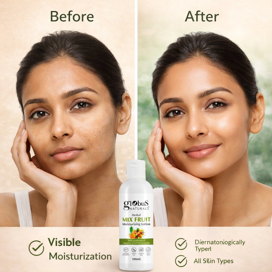 Herbal Moisturizing Lotion 100 ml each Pack of 4