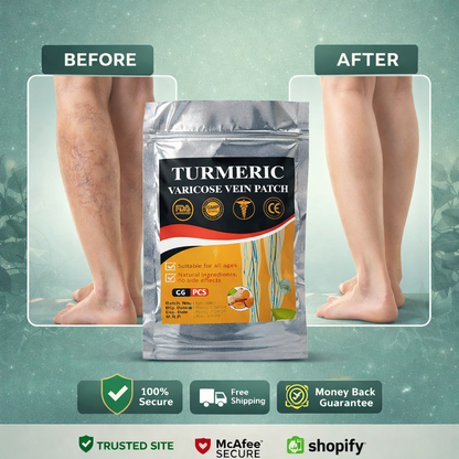 Turmeric Vericose Vein Patch (Pack of 10)