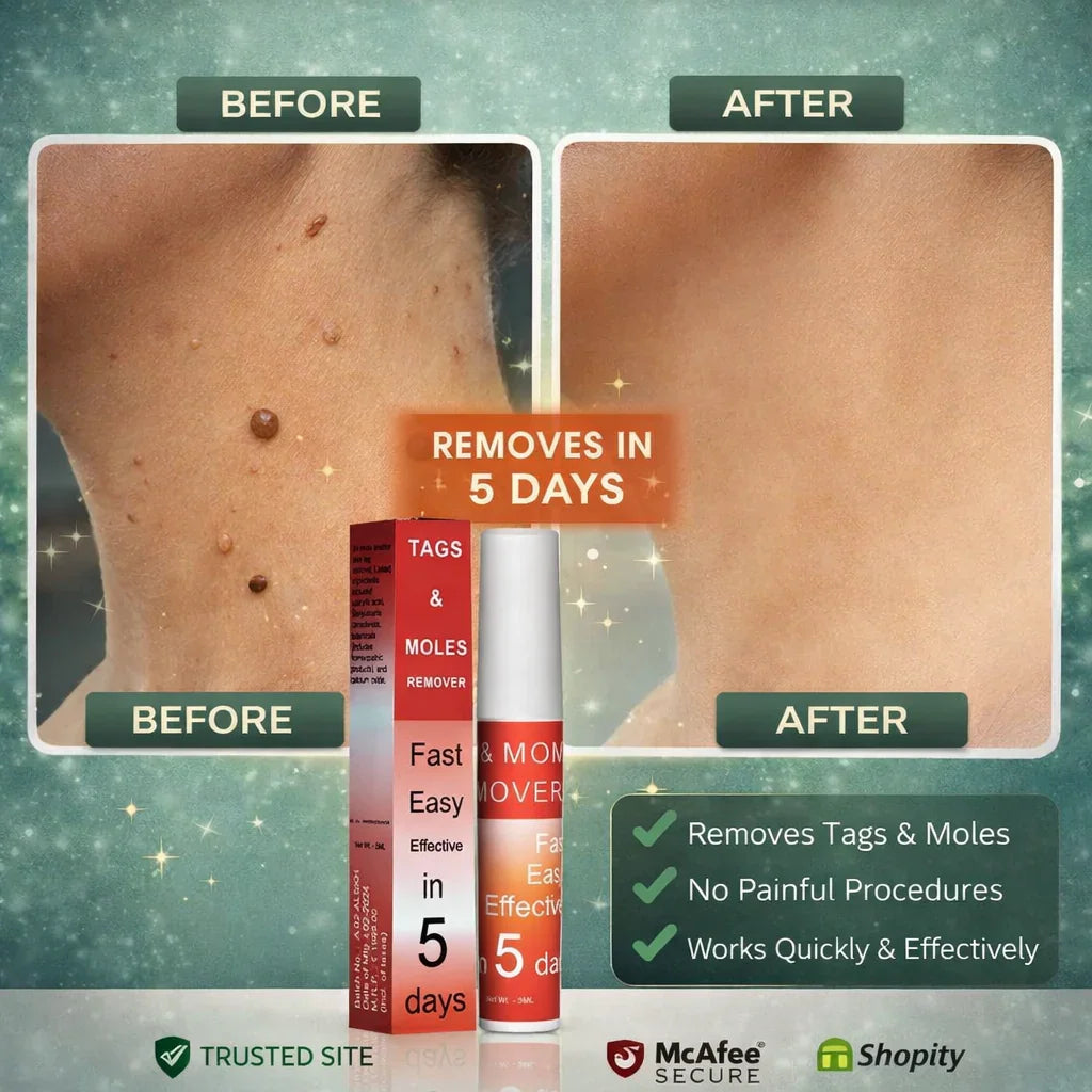 Tags & Moles Remover