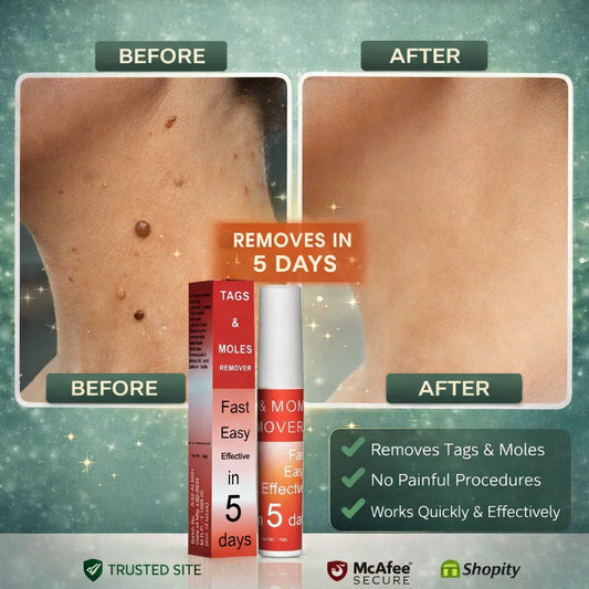 Tags & Moles Remover