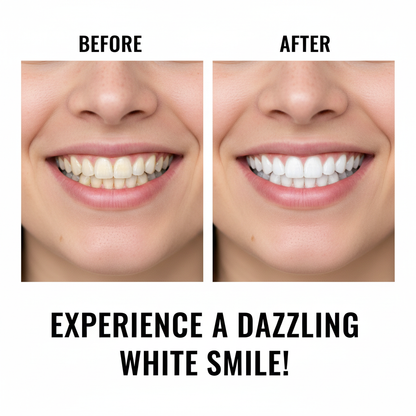 FM 😁 Get a Brighter Smile at Home – Easy Teeth Whitening Strips ✨